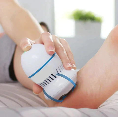 VYNO Vacuum Callus Remover